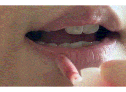 jLResV.gif