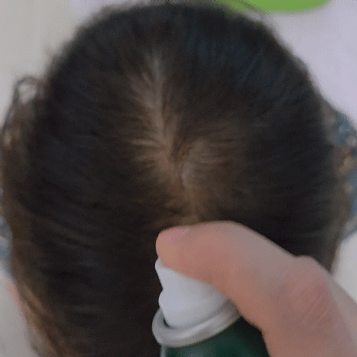 tsHCep.gif